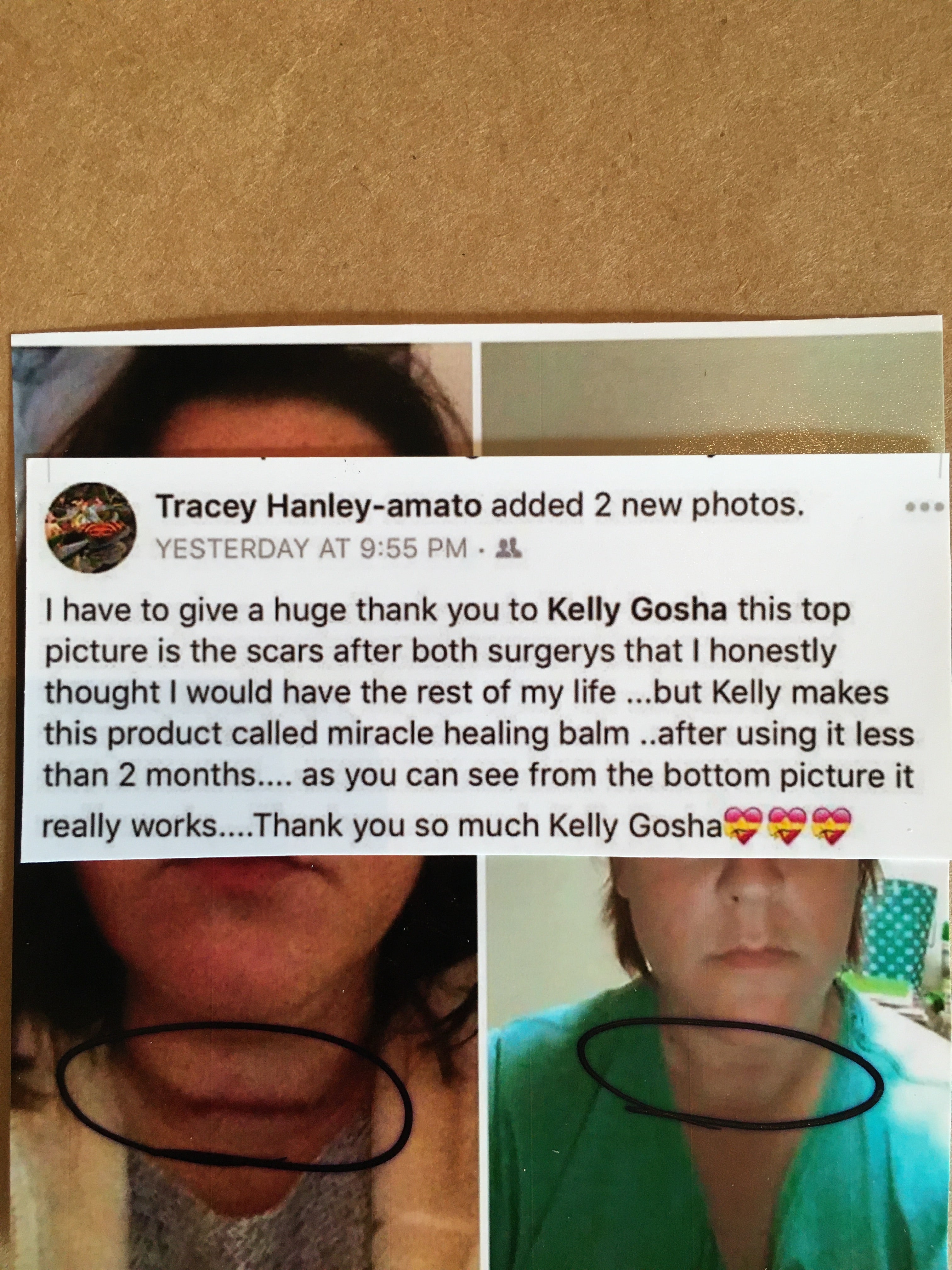 Miracle Healing Balm- 4oz